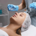 Chemical Peels Dubai