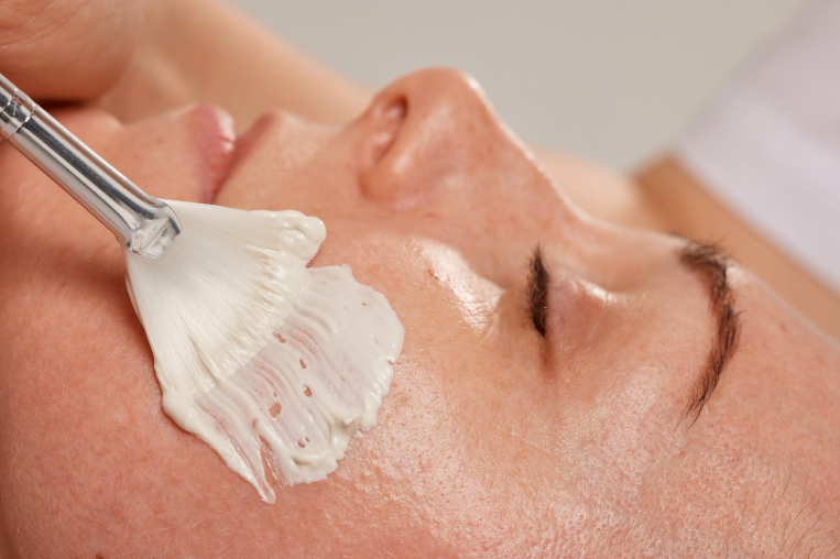 Discover the Right Chemical Peel for Your Skin in Dubai 2 Chemical Peels in Dubaii