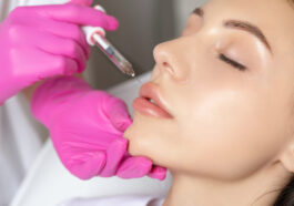 Painless lip filler