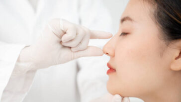 Rhinoplasty in Riyadh 6