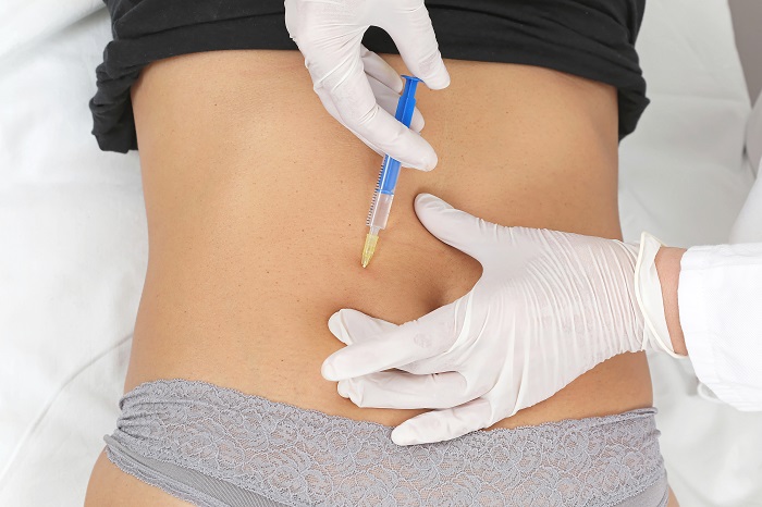 Beyond the Injection: The Timeline for Fat Dissolving Effects 2 Woman receiving Aqualyx injection to stomach 1