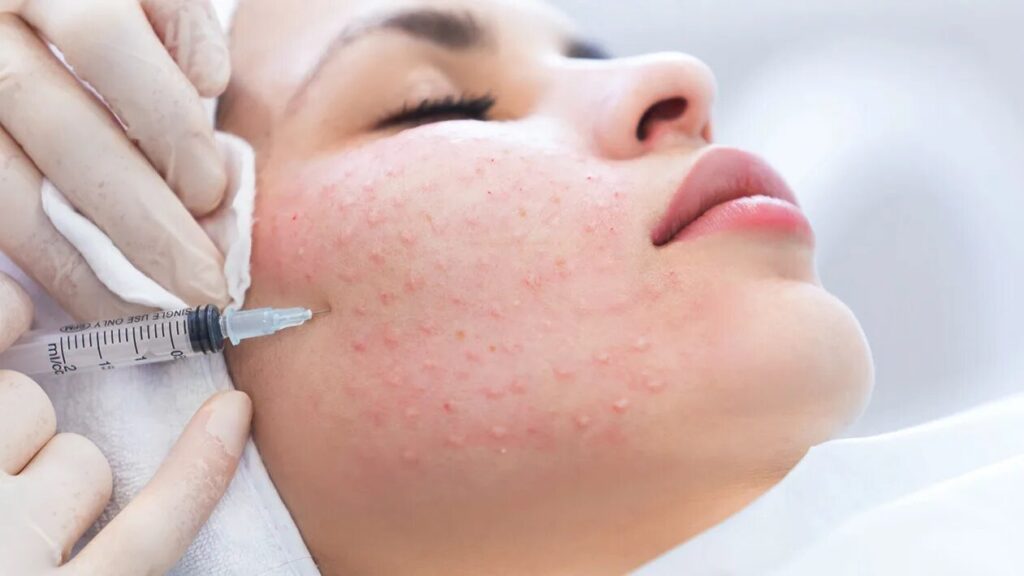 Are Skin Whitening Injections Safe for All Skin Types? 3 i 4 1