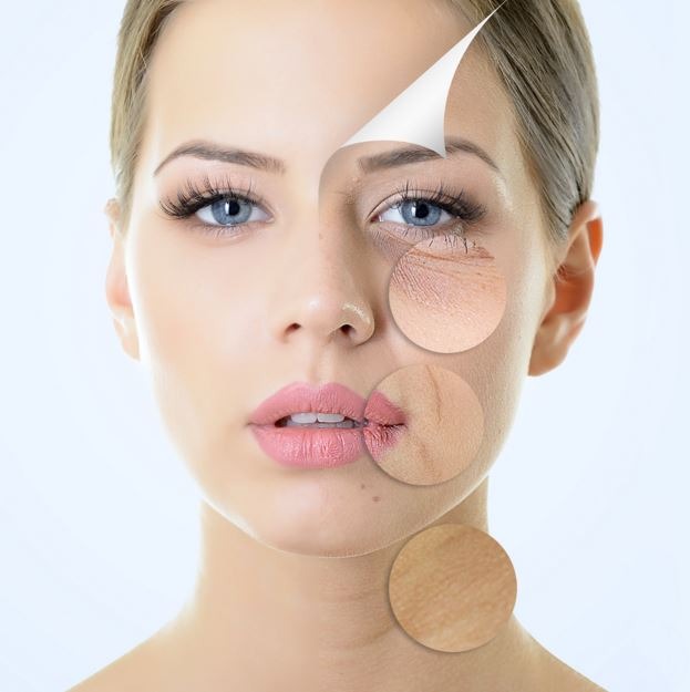 Cold Peel for Skin Transformation 3 Chemical Peels
