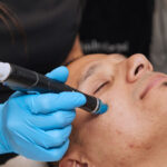 Hydrafacial Treatment That Detoxes and Illuminates Instantly 20 HydraFacial Robbie