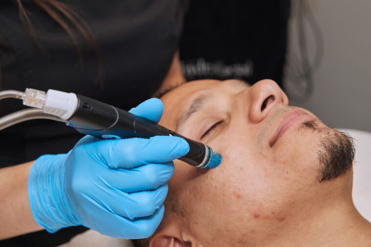HydraFacial Robbie