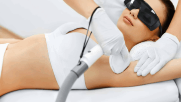 Is Laser Hair Removal Haram17