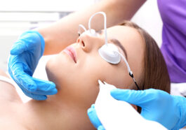 Laser Scar Removal 1