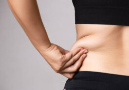 Liposuction in Riyadh 25
