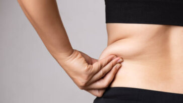 Liposuction in Riyadh 25
