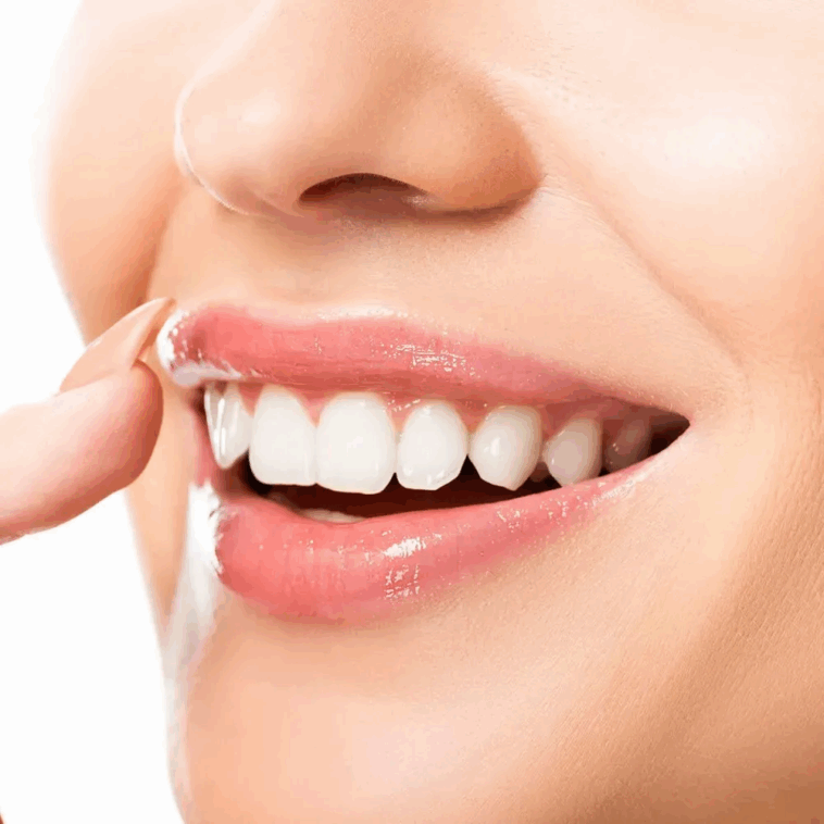 Quick Smile Makeover