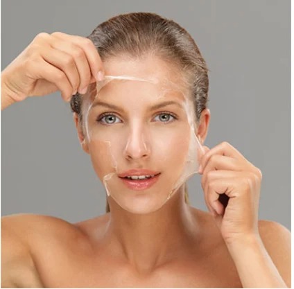 Cold Peel for Skin Transformation 2 chemical peel 500x500 1
