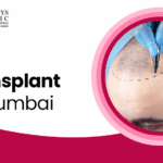 hair transplant in mumbai