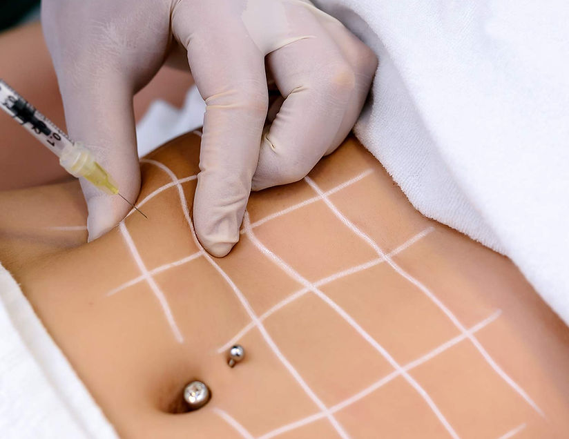 d64b93 9a2a183f4e0548899dfe6045c49215e5mv2