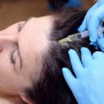 woman having hair loss injections