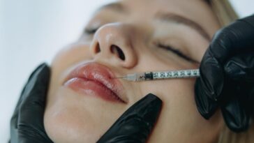 precision lip enhancement professional injectable treatment progress 476952 5020